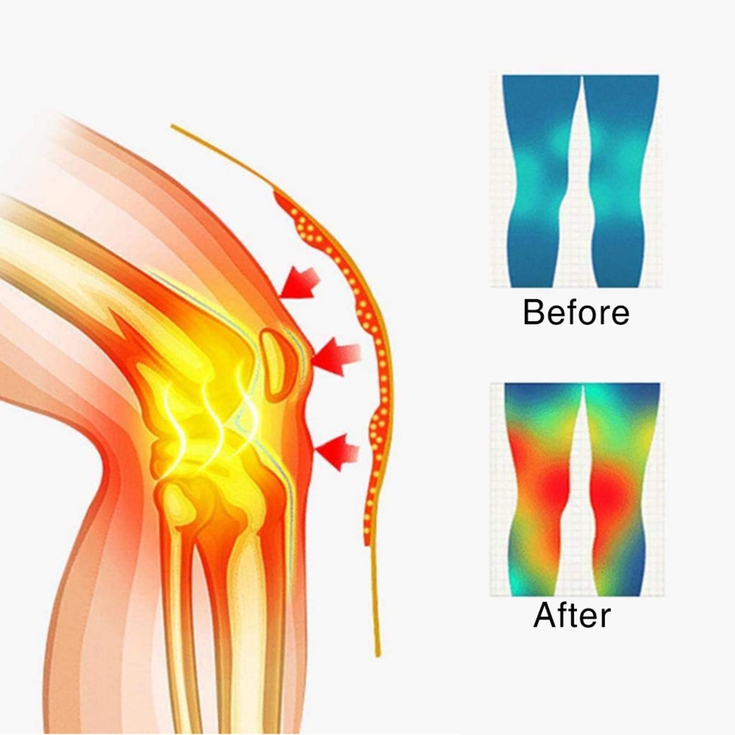 Self-Heating Knee Support Brace with Magnets for Pain Relief, 1 Pair
